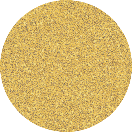 Disque abrasif Bosch EXPERT C470 125 mm grain 40.